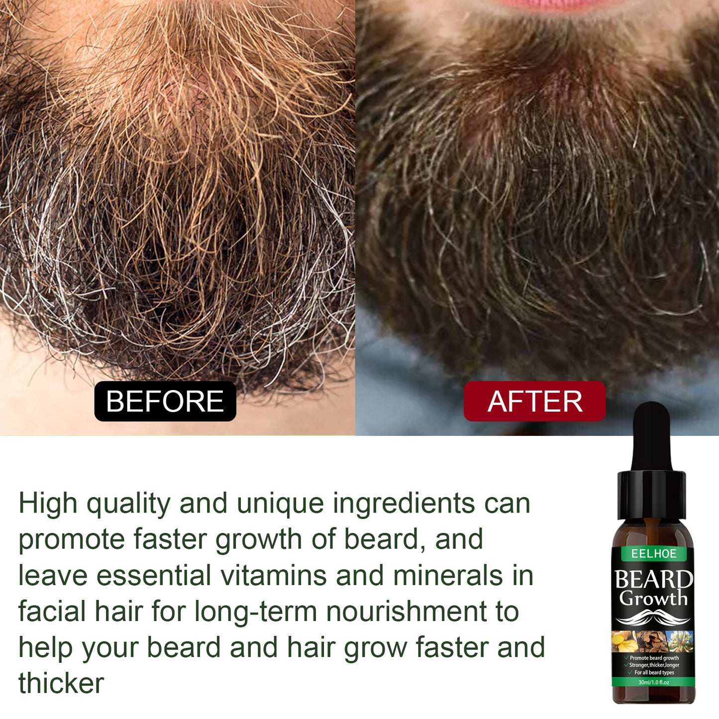 Moisturizing Mist Beard Care Intensive Fluid Treatment Oil