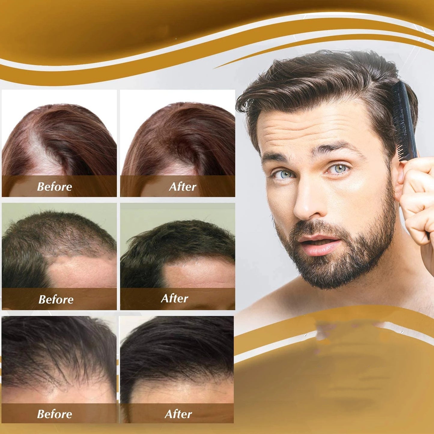 Anti Hair Loss Hair Nourishing Liquid Hair Firming And Hair Increasing