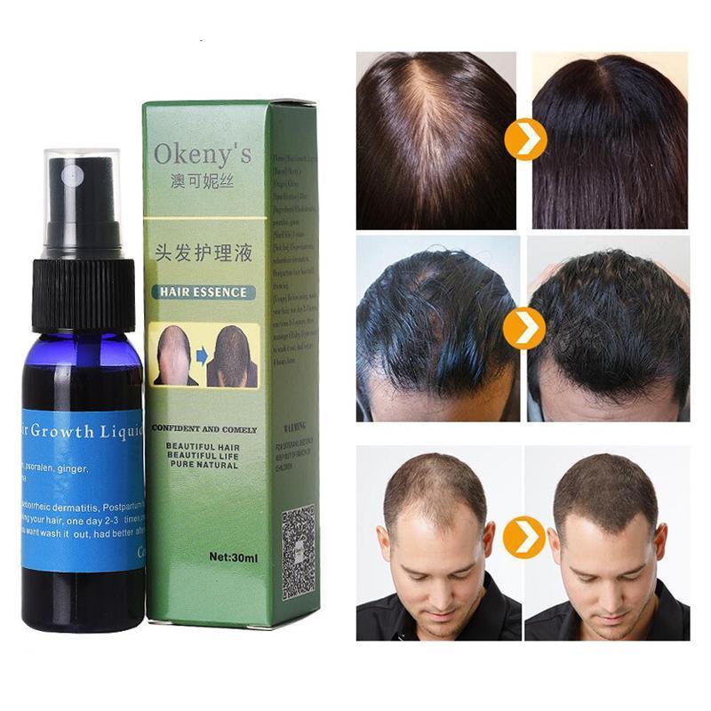 Sunburst Hair Growth Products for women&men Hair growth spray