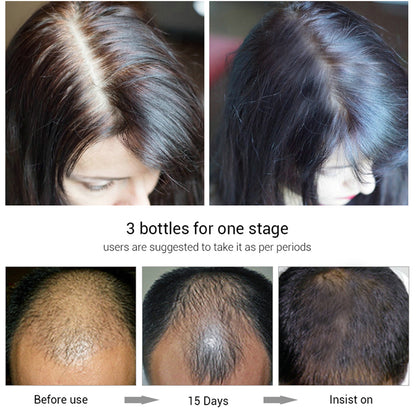 efero hair growth fluid