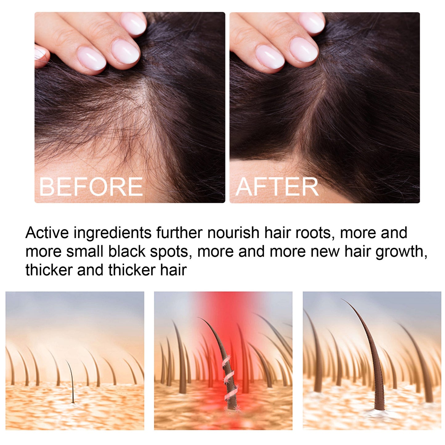 Ginger Hair Growth Moisturizing Nutrition Spray