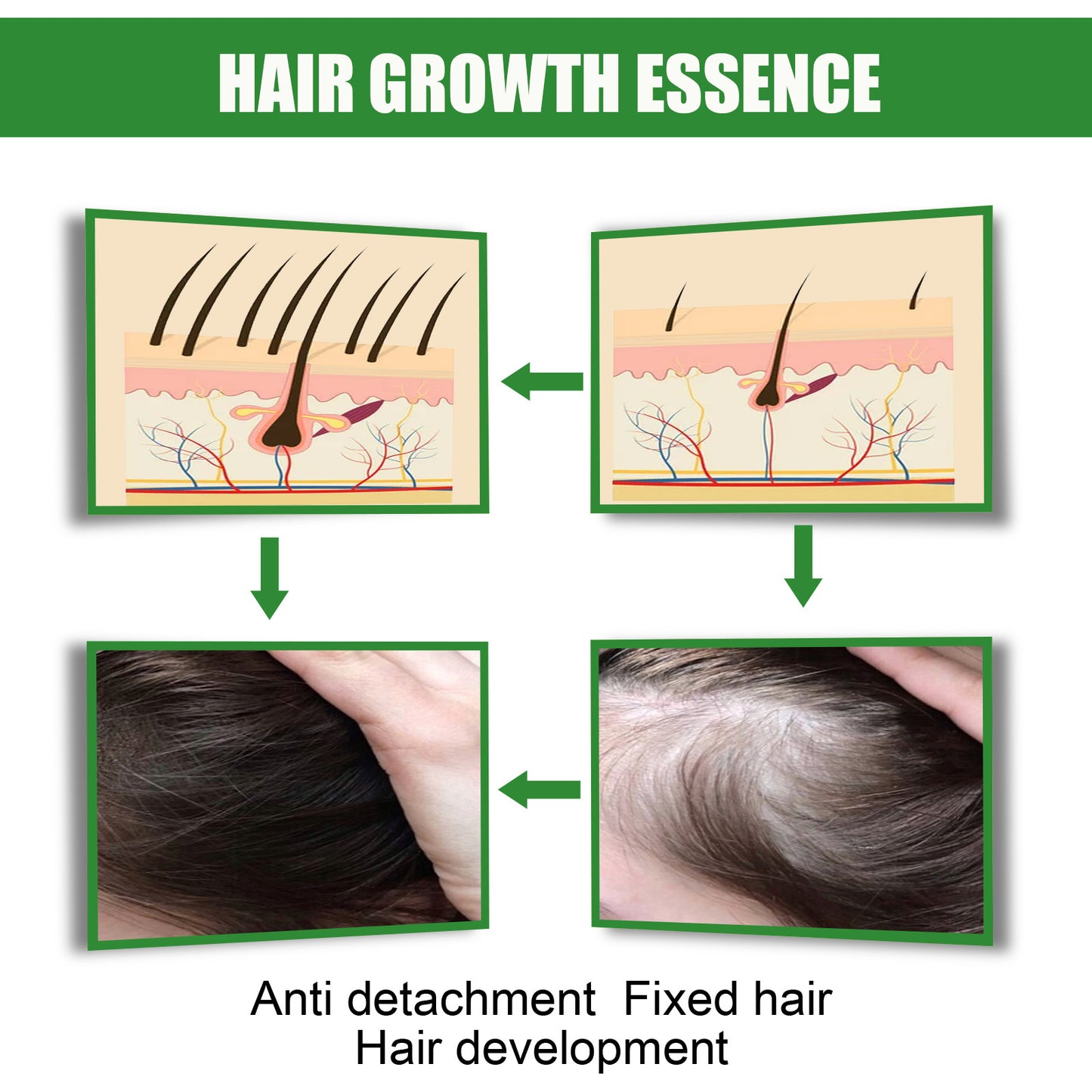 Ginger Hair Growth Moisturizing Nutrition Spray