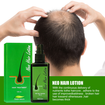 Best Seller Original Neo Hair Lotion Made in Thailand Hair Loss Scalp Treatment