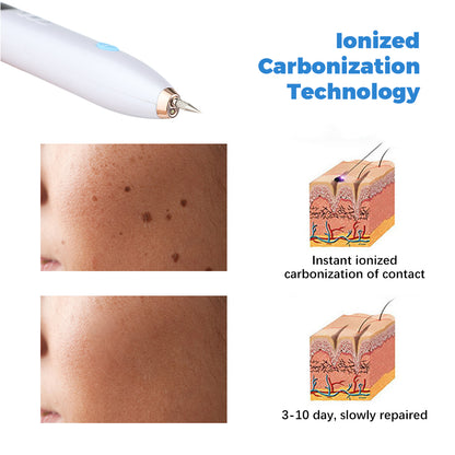 Special Offer Laser Skin Tag Face Mole Pen Freckle Black Spot Removal