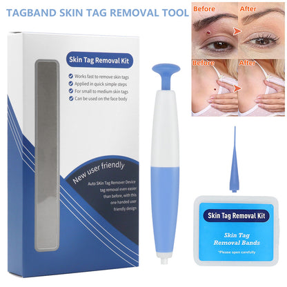 Special Offer Skin Tag Removal Kit Home Use Mole Wart Remover