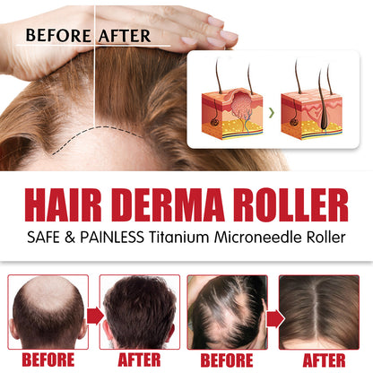 Hair Moisturizing Roller Cleaning Micro Needle Hair Comb