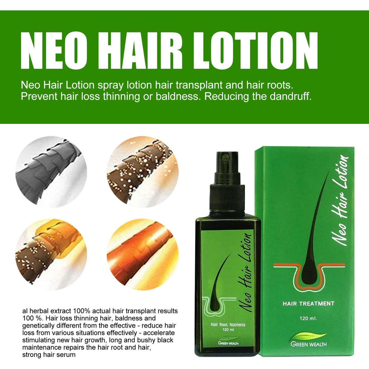 Neo Hair Lotion Growth Root Hair Loss Treatments Beards Sideburns Oil Thailand