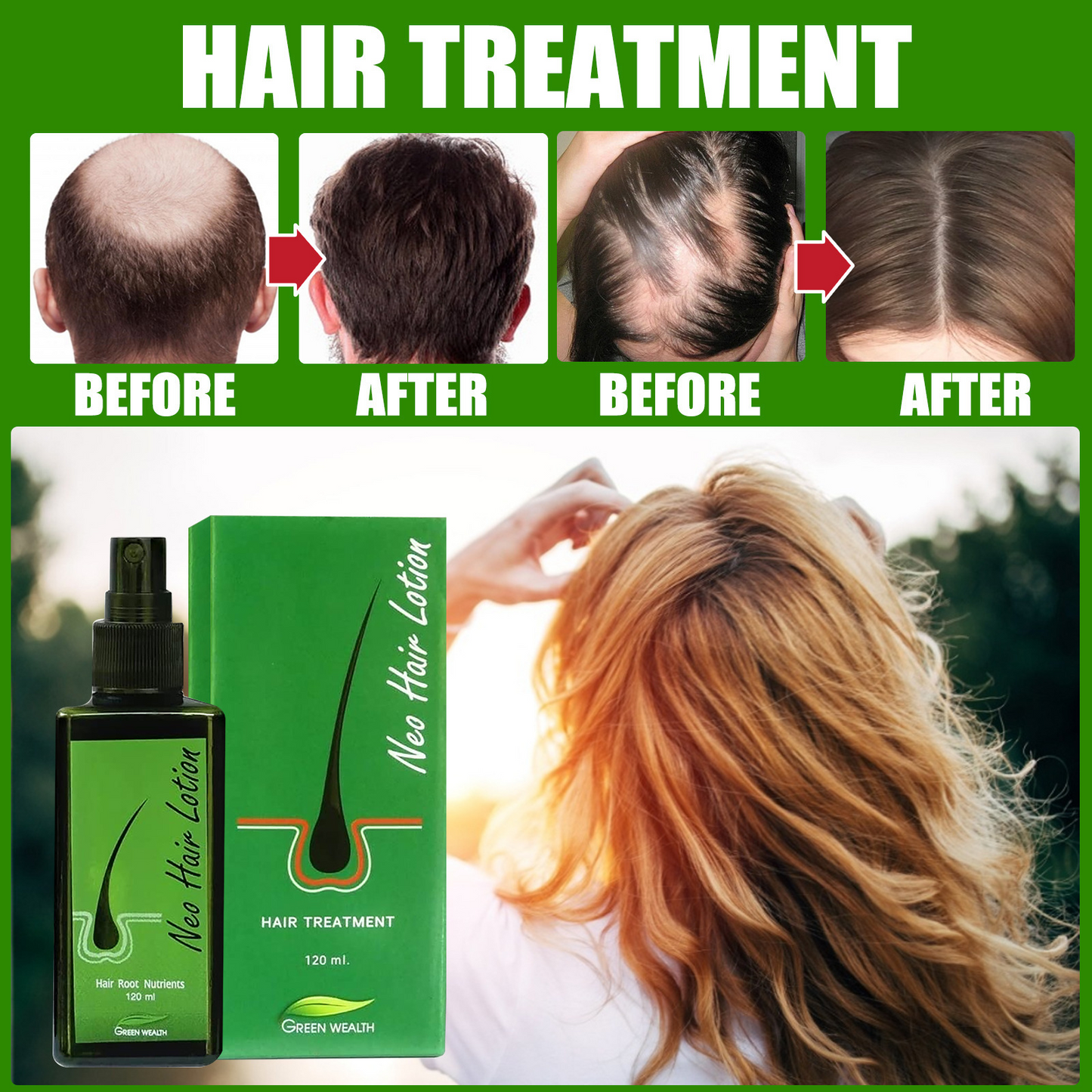 Neo Hair Lotion Growth Root Hair Loss Treatments Beards Sideburns Oil Thailand