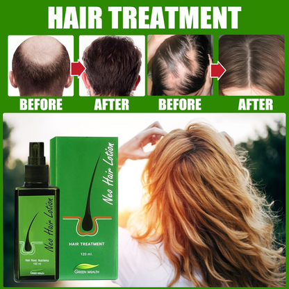 Best Seller Original Neo Hair Lotion Made in Thailand Hair Loss Scalp Treatment