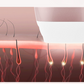 Laser Hair Removal Equipment Photon Skin Rejuvenation Hair Removal Equipment