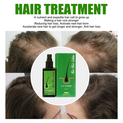 5 Pieces Neo Hair Lotion Thailand  Paradise Hair Treatment Hair Root Anti-Loss