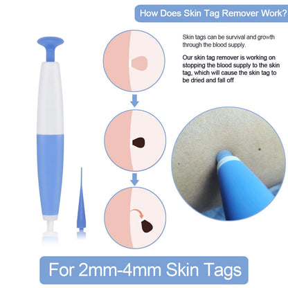 Special Offer Skin Tag Removal Kit Home Use Mole Wart Remover