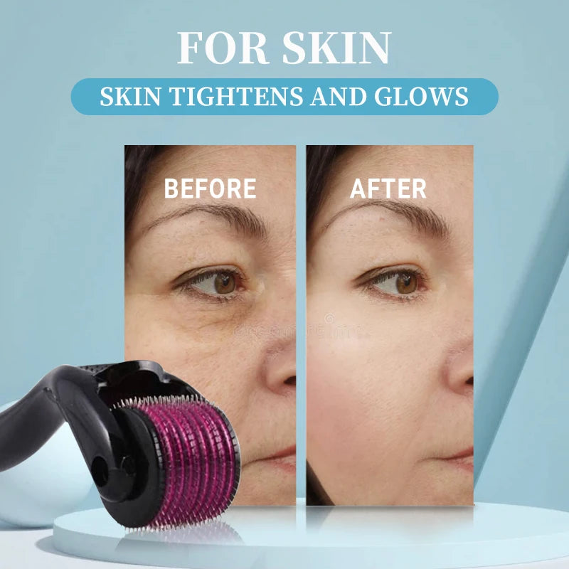 Micro Needling 540 Roller Derma Roller Professional Titanium