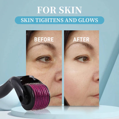 Micro Needling 540 Roller Derma Roller Professional Titanium