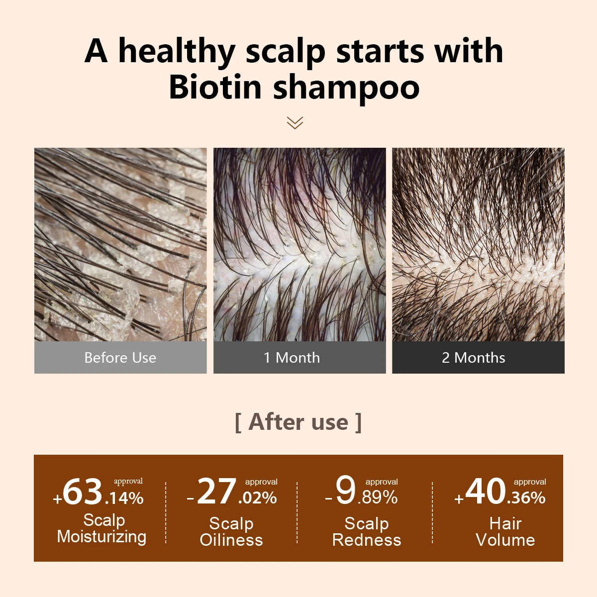 Prevent Hair Loss Shampoo And Conditioner Growth Oil