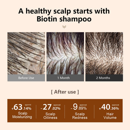 Prevent Hair Loss Shampoo And Conditioner Growth Oil