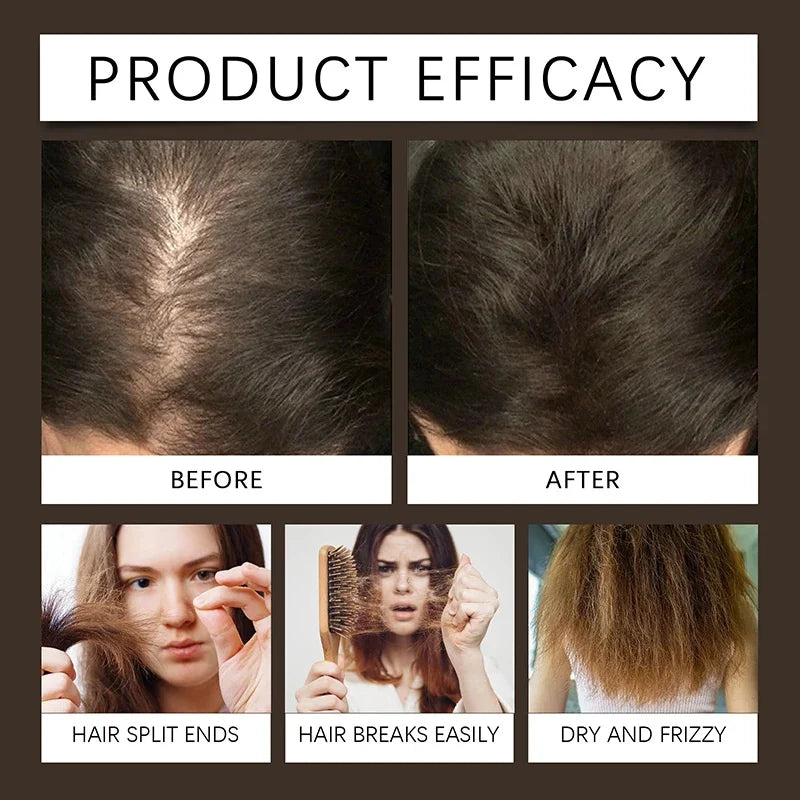 Biotin Fast Hair Growth Spray Anti Hair Loss Serum Prevent Baldness