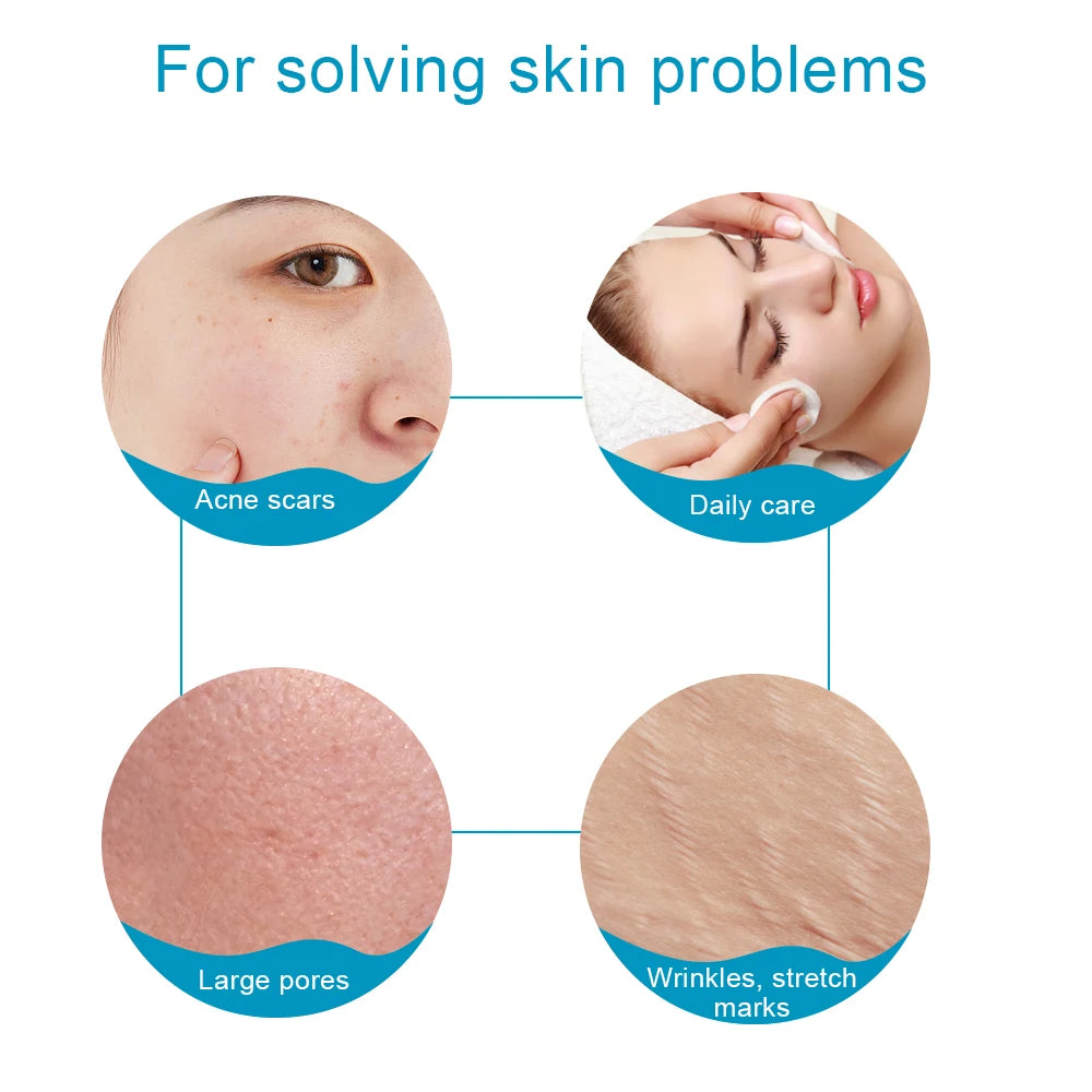 540 Derma Roller Skin Care Micro Needle Dermaroller