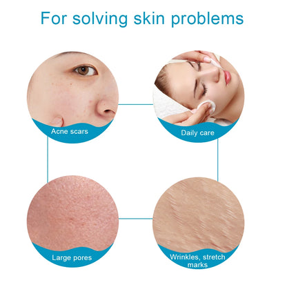 540 Derma Roller Skin Care Micro Needle Dermaroller