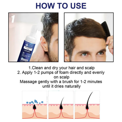 Powerful Hair Growth Foam Anti Loss Fast Growing Scalp