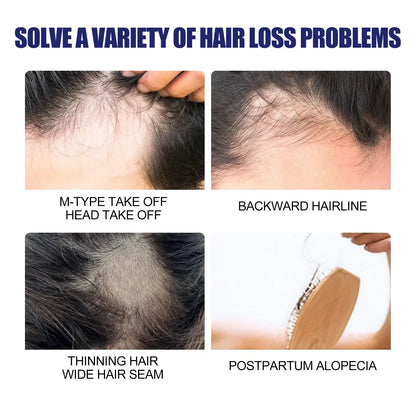 Powerful Hair Growth Foam Anti Loss Fast Growing Scalp