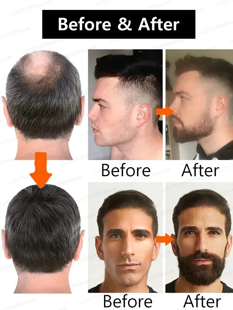 The secret to becoming a stylish man! Beard Oil