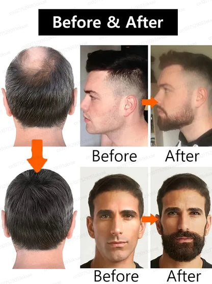 The secret to becoming a stylish man! Beard Oil