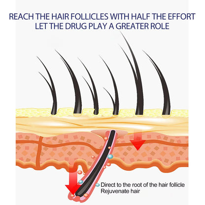 Powerful Hair Growth Foam Anti Loss Fast Growing Scalp