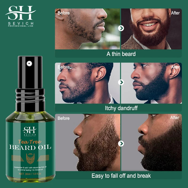 SEVICH Growth Beard Oil for Men Moisturizing Oil