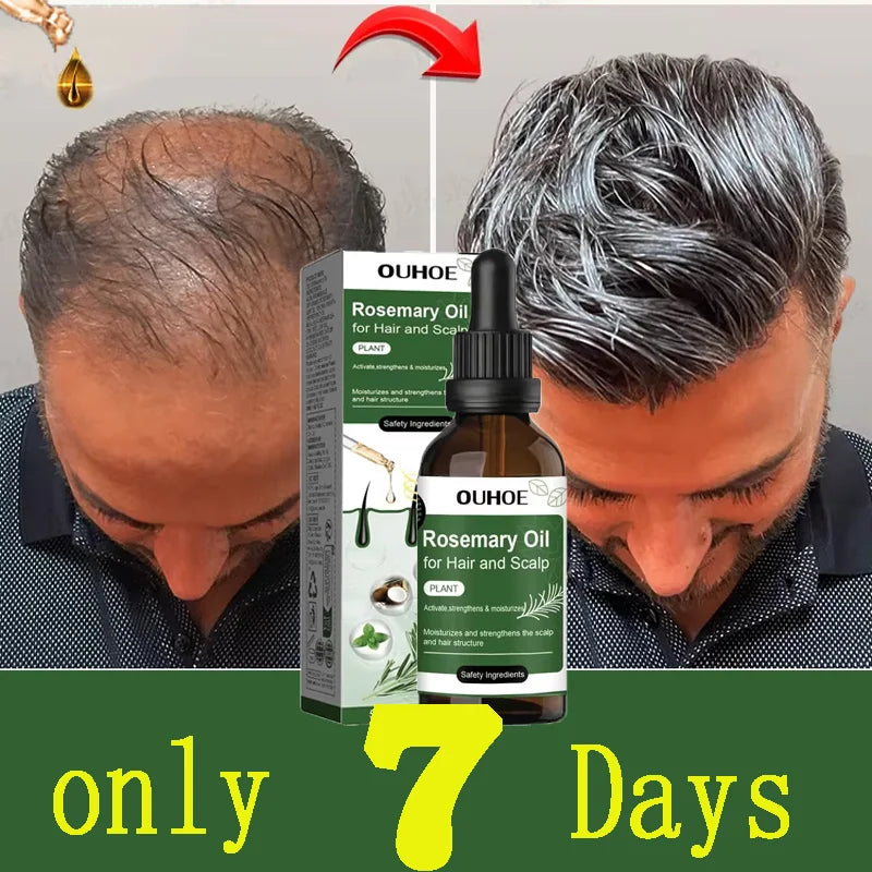 Anti Hairs Loss Treatment Mint Hair Growth Oil Nourishing