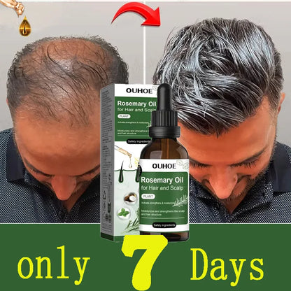 Anti Hairs Loss Treatment Mint Hair Growth Oil Nourishing