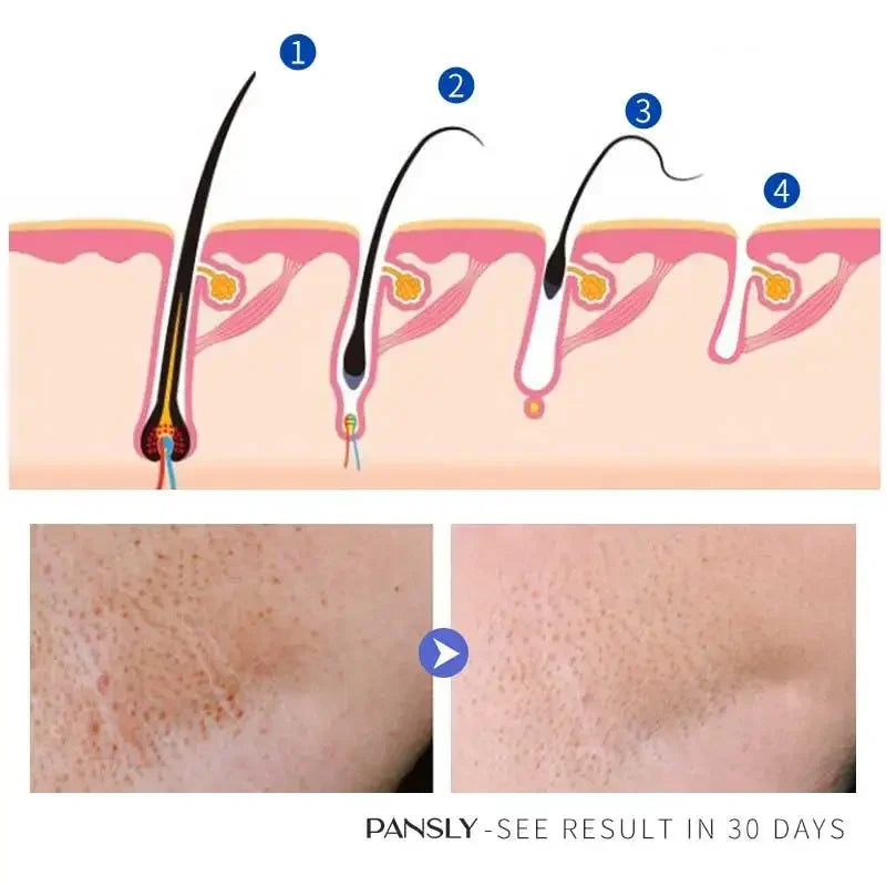 50g Hair Removal Cream for Unisex Reduce Hair Growth