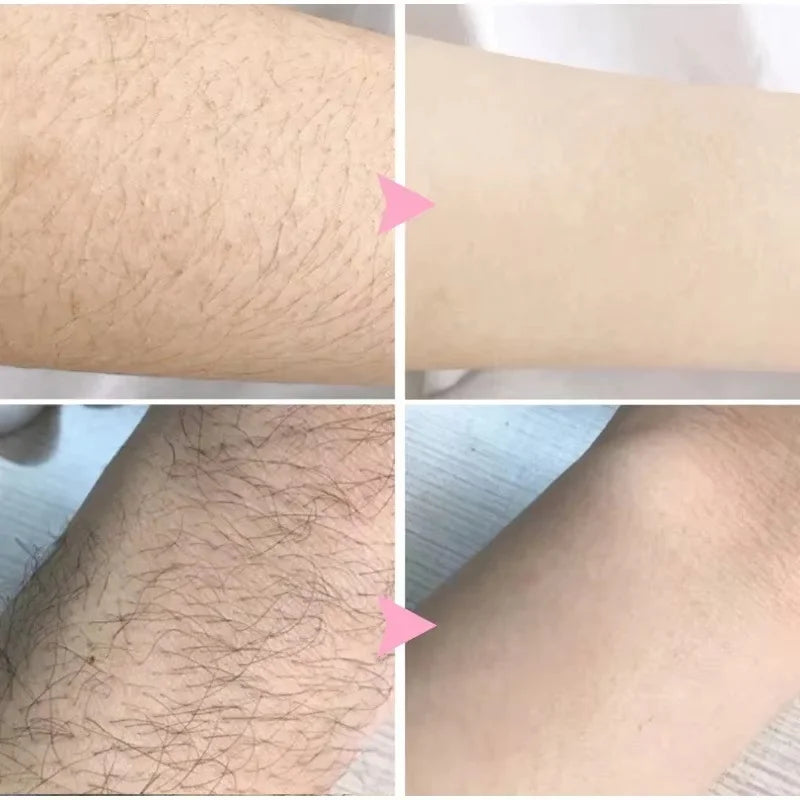 2 Minutes Painless Fast Hair Removal Spray