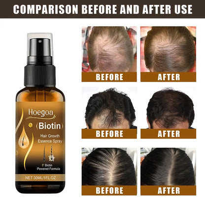 Biotin Fast Hair Growth Spray Anti Hair Loss Serum Prevent Baldness