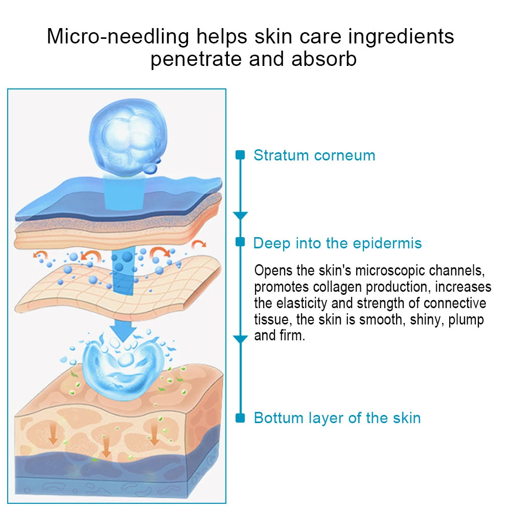 540 Derma Roller Skin Care Micro Needle Dermaroller