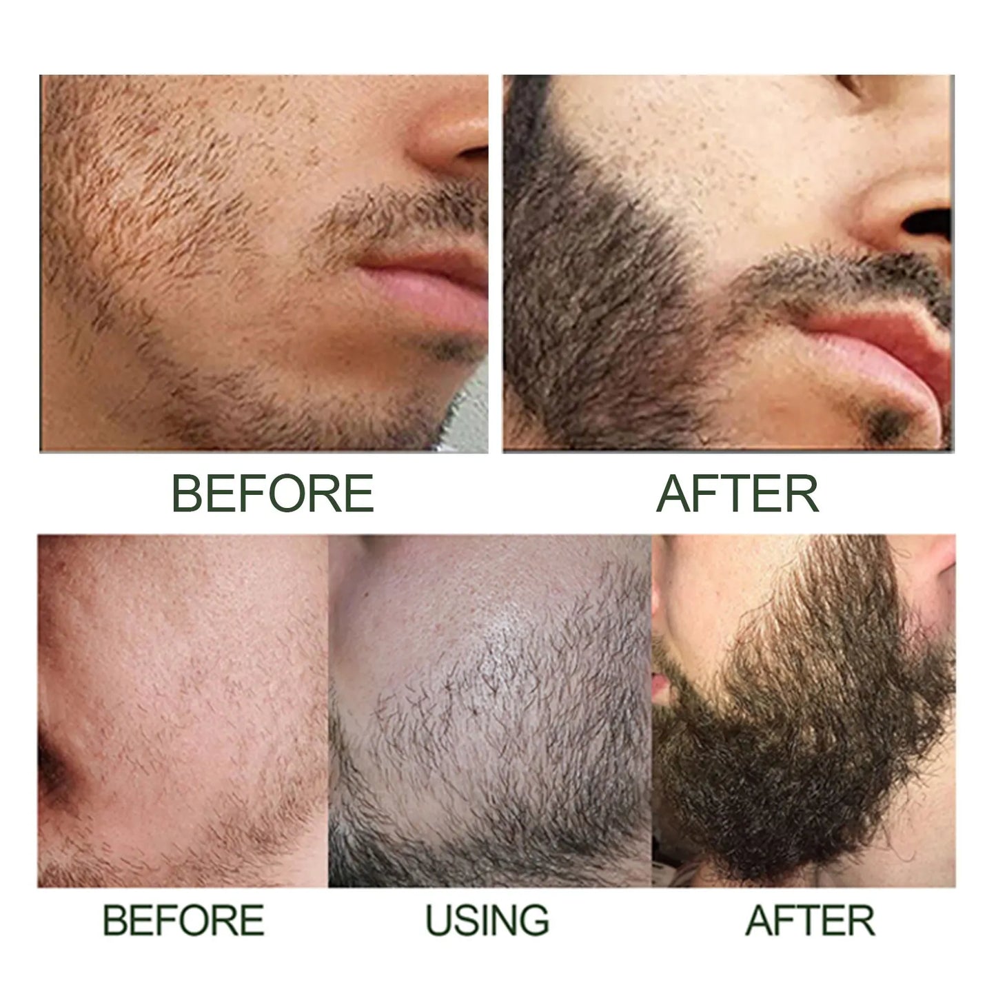 Beard Care Essence Set Men's Beard Care