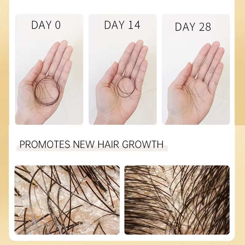 Prevent Hair Loss Shampoo And Conditioner Growth Oil