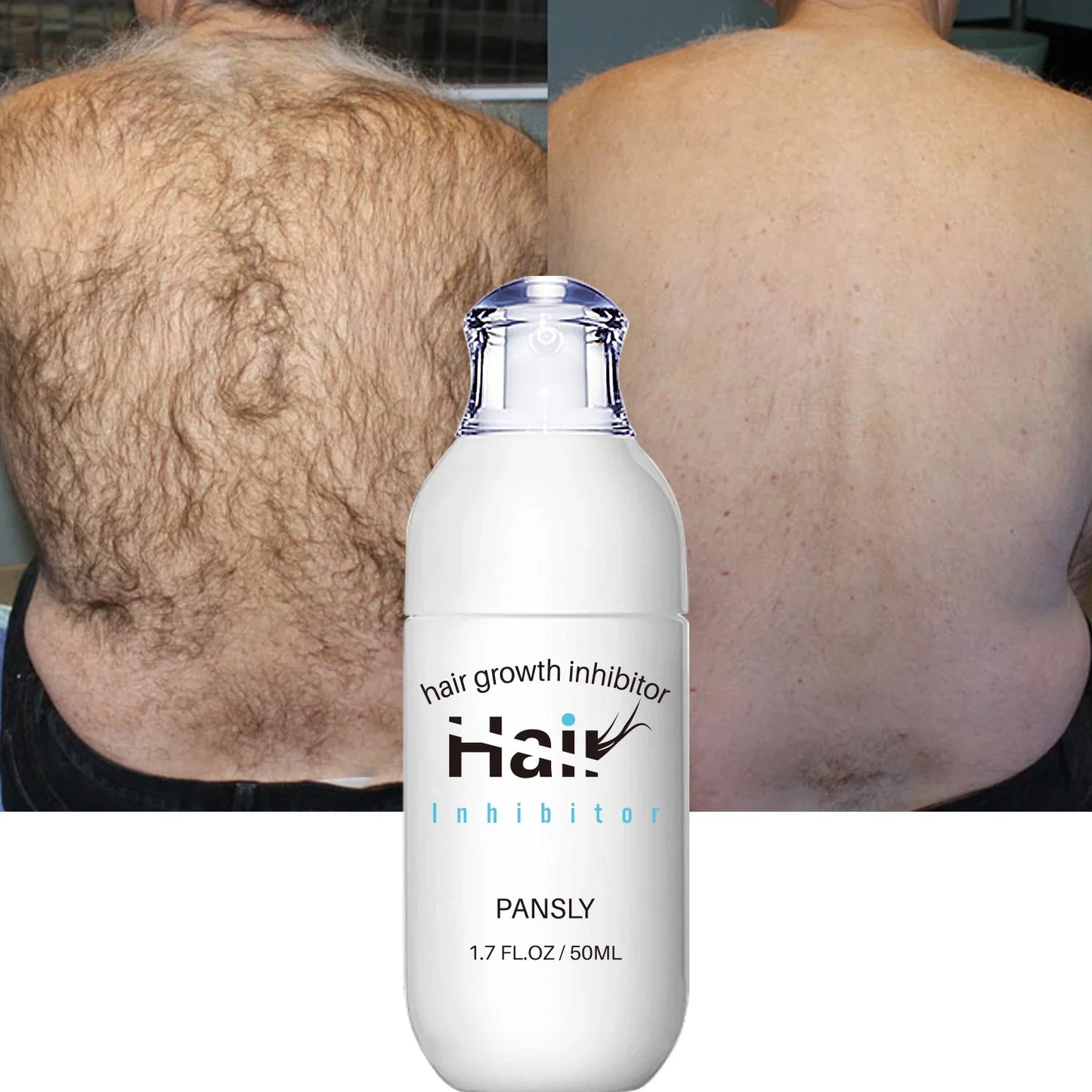 Non Irritating Hair Removal Cream and Spray for Men and Women