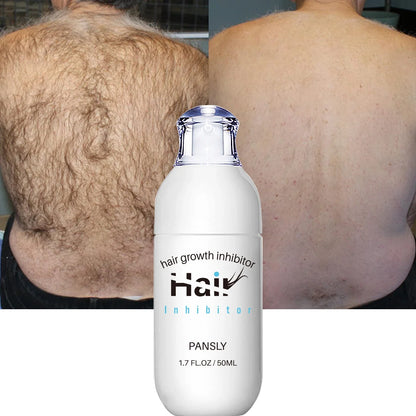 Non Irritating Hair Removal Cream and Spray for Men and Women