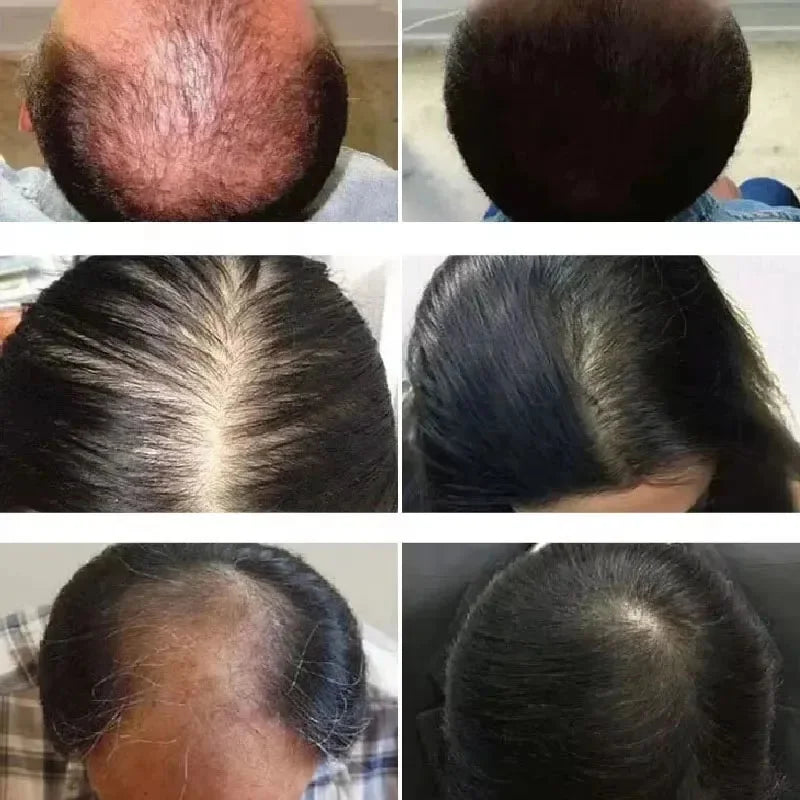 Anti Hairs Loss Treatment Mint Hair Growth Oil Nourishing