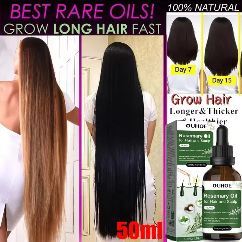 Anti Hairs Loss Treatment Mint Hair Growth Oil Nourishing