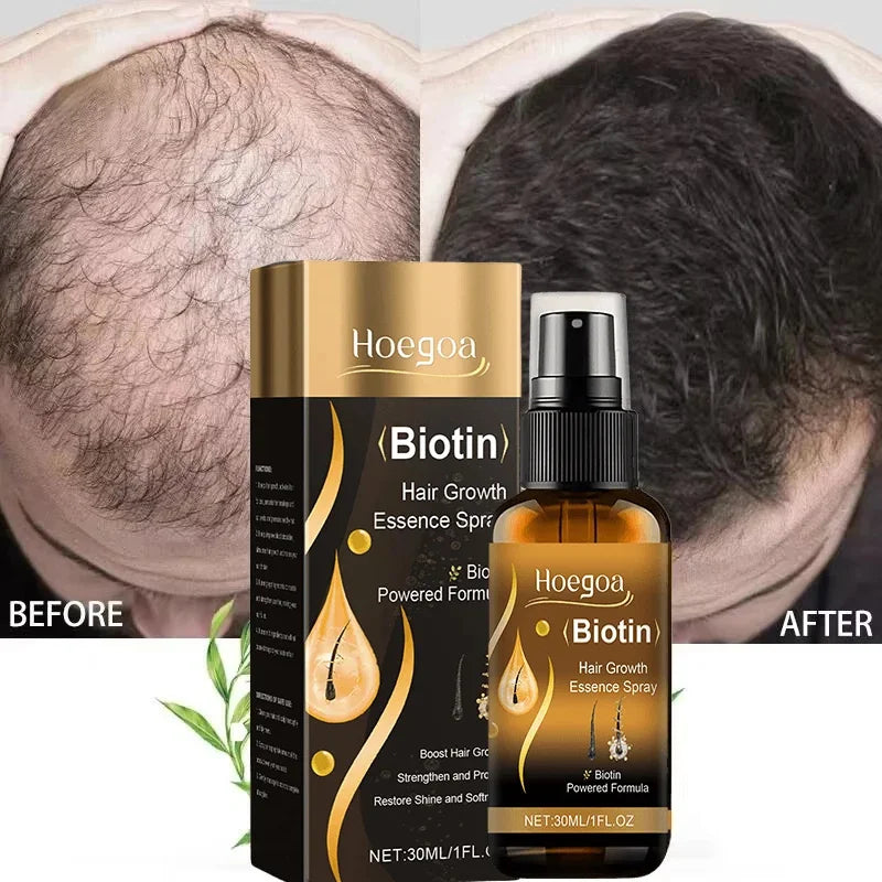 Biotin Fast Hair Growth Spray Anti Hair Loss Serum Prevent Baldness