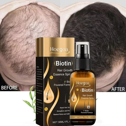 Biotin Fast Hair Growth Spray Anti Hair Loss Serum Prevent Baldness