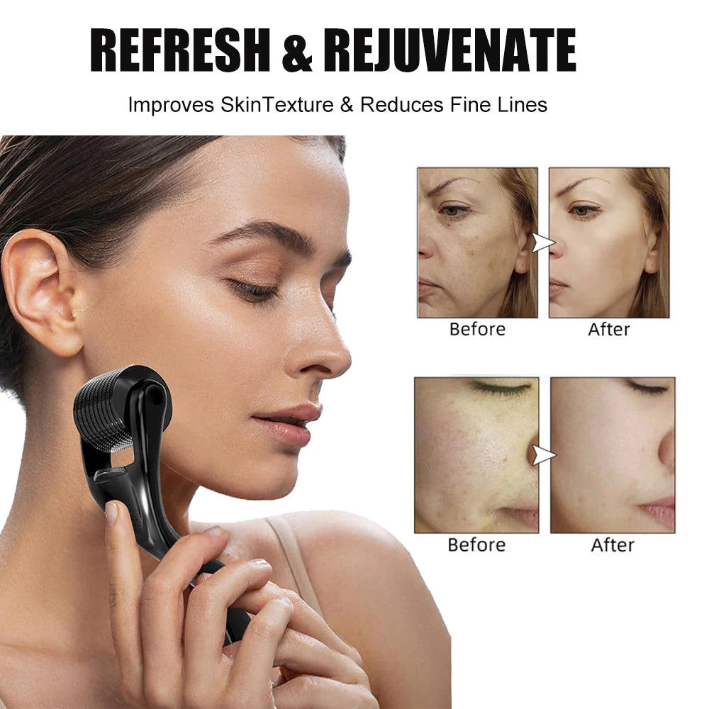 Professional 540 Derma Roller For Beard Hair Growth
