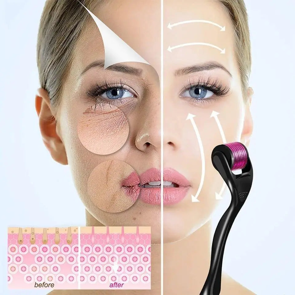 540 Derma Roller for Hair and Beard Growth Microneedle