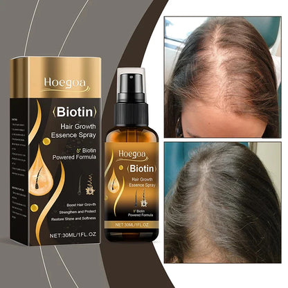 Biotin Fast Hair Growth Spray Anti Hair Loss Serum Prevent Baldness