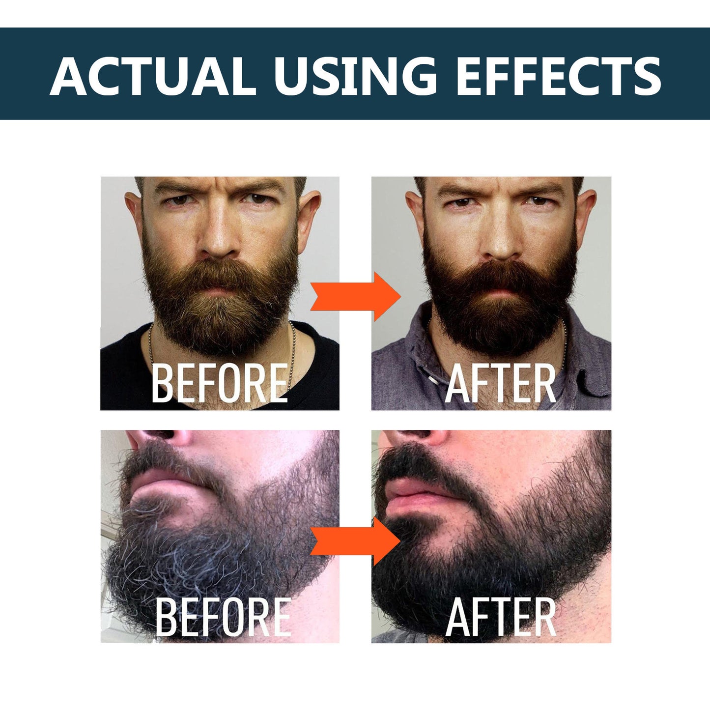 Beard Care Solution Gentle And Shine