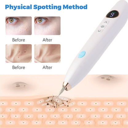 Special Offer Laser Skin Tag Face Mole Pen Freckle Black Spot Removal