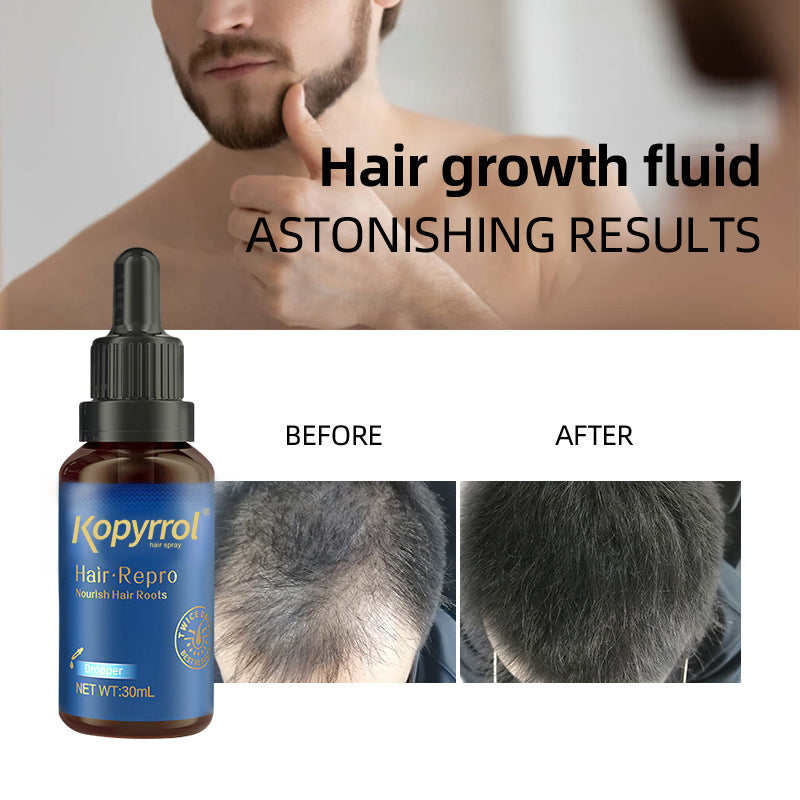 Hair-care Lotion For Men And Women's Hairline
