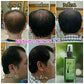 Neo Hair Lotion 120ml Hair Treatment Hair Root